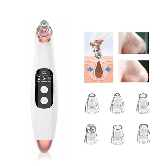 ClearSkin Power Pore Vacuum