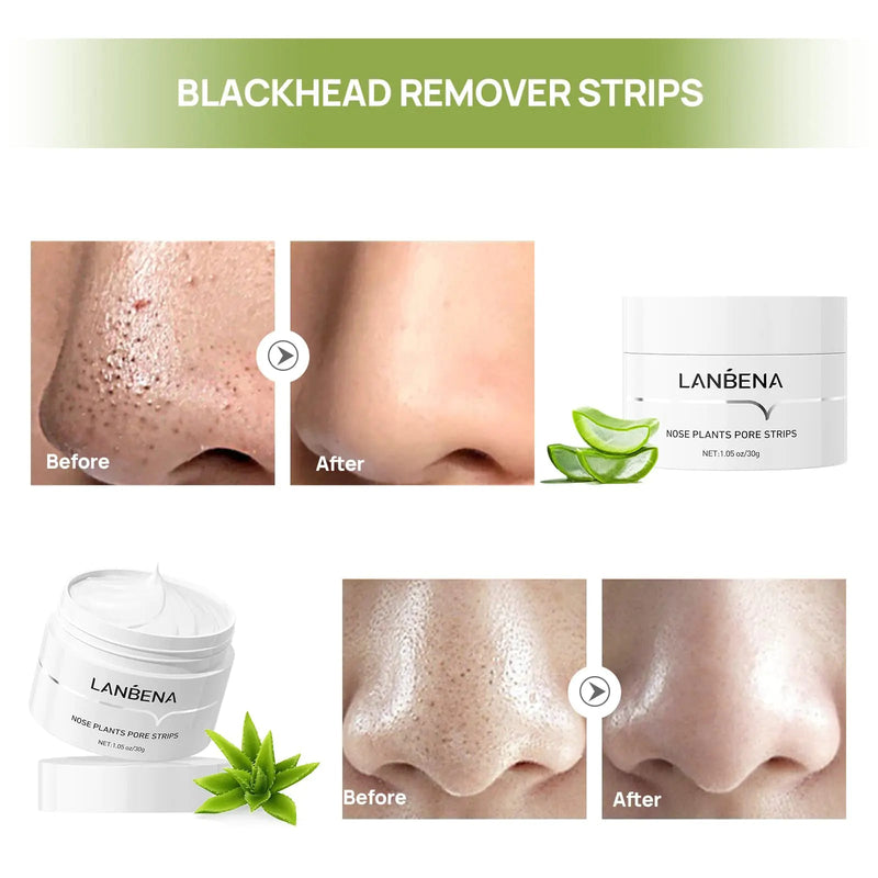 LANBENA Blackhead Purifying Peel Mask