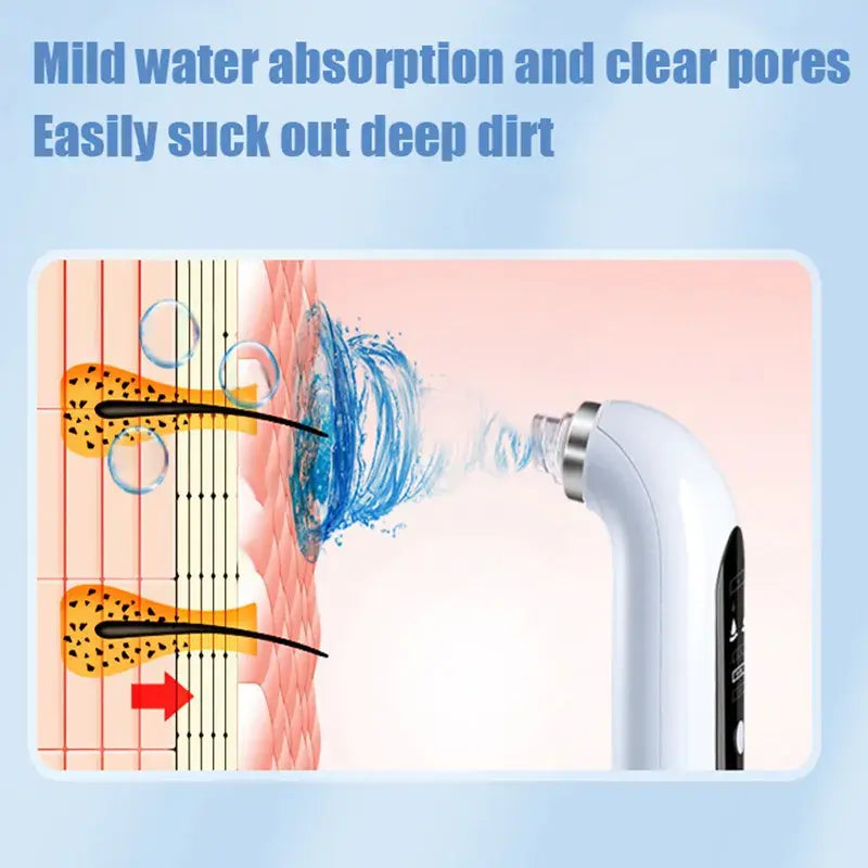 ClearSkin Power Pore Vacuum