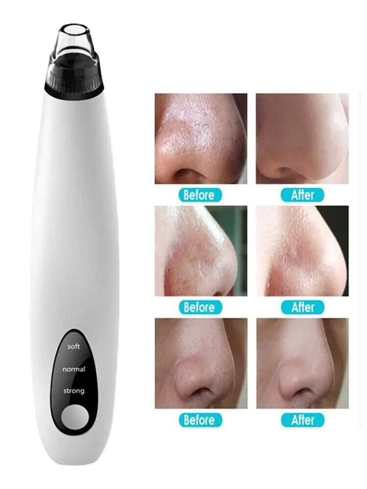 GlowPerfect Deep Pore Vacuum Cleaner